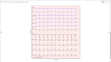 ECG Preview